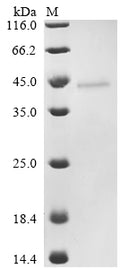 (Tris-Glycine gel) Discontinuous SDS-PAGE (reduced) with 5% enrichment gel and 15% separation gel.