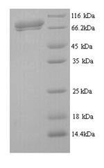 Recombinant Influenza C virus Hemagglutinin-esterase-fusion glycoprotein (HE), partial – Figure 1 of 1