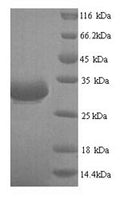 Recombinant Escherichia phage T7 Single-stranded DNA-binding protein (2.5) – Figure 1 of 1