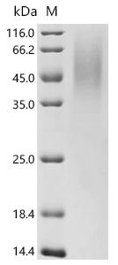 (Tris-Glycine gel) Discontinuous SDS-PAGE (reduced) with 5% enrichment gel and 15% separation gel.