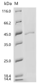 (Tris-Glycine gel) Discontinuous SDS-PAGE (reduced) with 5% enrichment gel and 15% separation gel.