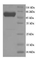 Recombinant Danio rerio D-2-hydroxyglutaRate dehydrogenase, mitochondrial (d2hgdh) – Figure 1 of 1