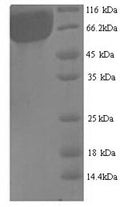 Recombinant Aspergillus niger Probable alpha-galactosidase B (aglB) – Figure 1 of 1