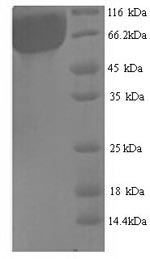 Recombinant Aspergillus niger Probable alpha-galactosidase B (aglB) – Figure 1 of 1