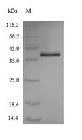 Recombinant Acinetobacter baumannii Outer membrane protein Omp38 (omp38) – Figure 1 of 1