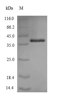 Recombinant Acinetobacter baumannii Outer membrane protein Omp38 (omp38) – Figure 1 of 1
