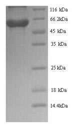Recombinant Rabies virus Glycoprotein (G), partial – Figure 1 of 1