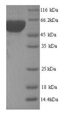 Recombinant Yersinia pestis 60KDA chaperonin (groL) – Figure 1 of 1