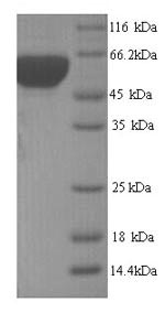 Recombinant Yersinia pestis 60KDA chaperonin (groL) – Figure 1 of 1