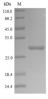 (Tris-Glycine gel) Discontinuous SDS-PAGE (reduced) with 5% enrichment gel and 15% separation gel.