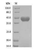 (Tris-Glycine gel) Discontinuous SDS-PAGE (reduced) with 5% enrichment gel and 15% separation gel.
