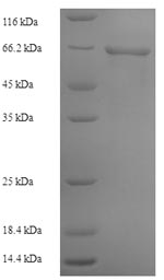 Recombinant Bacteroides vulgatus Alpha-1,3-galactosidase B (glaB1) – Figure 1 of 1