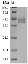 (Tris-Glycine gel) Discontinuous SDS-PAGE (reduced) with 5% enrichment gel and 15% separation gel.