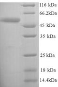 Recombinant Salmonella heidelberg D-serine dehydratase (dsdA) – Figure 1 of 1