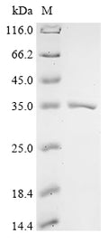 (Tris-Glycine gel) Discontinuous SDS-PAGE (reduced) with 5% enrichment gel and 15% separation gel.