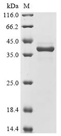 (Tris-Glycine gel) Discontinuous SDS-PAGE (reduced) with 5% enrichment gel and 15% separation gel.