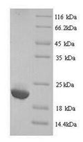 Recombinant Human Immunoglobulin lambda-like polypeptide 5 (IGLL5) – Figure 1 of 1