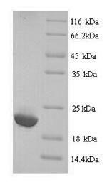 Recombinant Human Immunoglobulin lambda-like polypeptide 5 (IGLL5) – Figure 1 of 1