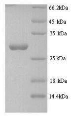 Recombinant Streptomyces actuosus Nosiheptide precursor (nosM) – Figure 1 of 1