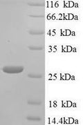 Recombinant Klebsiella pneumoniae Metallo-beta-lactamase type 2 (blaNDM-1) – Figure 1 of 1
