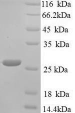 Recombinant Klebsiella pneumoniae Metallo-beta-lactamase type 2 (blaNDM-1) – Figure 1 of 1