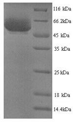 Recombinant Shigella flexneri serotype X E3 ubiquitin-protein ligase ipaH9.8 (ipaH9.8) – Figure 1 of 1