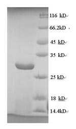 Recombinant Human cytomegalovirus Envelope glycoprotein L (gL) – Figure 1 of 1