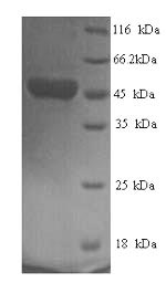 Recombinant Human respiRatory syncytial virus B Fusion glycoprotein F0 (F), partial – Figure 1 of 1
