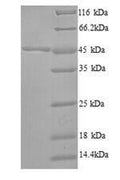 Recombinant Bacillus subtilis 3-oxoacyl-[acyl-carrier-protein] synthase 2 (fabF) – Figure 1 of 1