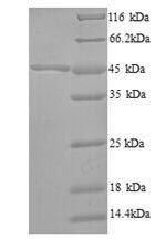 Recombinant Bacillus subtilis 3-oxoacyl-[acyl-carrier-protein] synthase 2 (fabF) – Figure 1 of 1