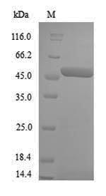 (Tris-Glycine gel) Discontinuous SDS-PAGE (reduced) with 5% enrichment gel and 15% separation gel.