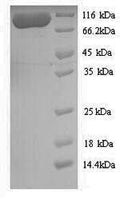 Recombinant Aquifex aeolicus DNA mismatch repair protein MutS (mutS) – Figure 1 of 1