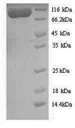 Recombinant Aquifex aeolicus DNA mismatch repair protein MutS (mutS) – Figure 1 of 1