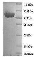 Recombinant Schizosaccharomyces pombe Sulfide:quinone oxidoreductase, mitochondrial (hmt2) – Figure 1 of 1