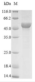 (Tris-Glycine gel) Discontinuous SDS-PAGE (reduced) with 5% enrichment gel and 15% separation gel.