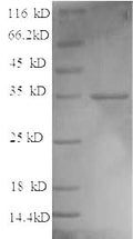 Recombinant Bacillus thuringiensis subsp. Pesticidal crystal protein cry1Fb (cry1Fb), partial – Figure 1 of 1