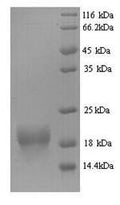 Recombinant Mouse Bis (5'-adenosyl)-triphosphatase (Fhit) – Figure 1 of 1