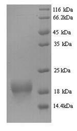 Recombinant Mouse Bis (5'-adenosyl)-triphosphatase (Fhit) – Figure 1 of 1