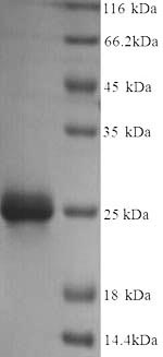 Recombinant Escherichia coli Ribose-5-phosphate isomerase A (rpiA) – Figure 1 of 1