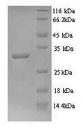 Recombinant Mycobacterium tuberculosis Signal peptidase I (lepB), partial – Figure 1 of 1