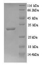 Recombinant Mycobacterium tuberculosis Signal peptidase I (lepB), partial – Figure 1 of 1