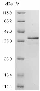 (Tris-Glycine gel) Discontinuous SDS-PAGE (reduced) with 5% enrichment gel and 15% separation gel.