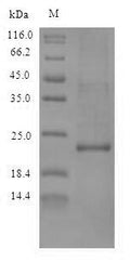 Recombinant Callithrix jacchus Interleukin-10 (IL10) – Figure 1 of 1