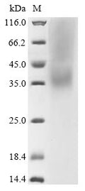 (Tris-Glycine gel) Discontinuous SDS-PAGE (reduced) with 5% enrichment gel and 15% separation gel.