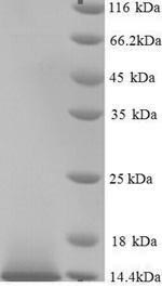 Recombinant Human Guanylate cyclase activator 2B (GUCA2B) – Figure 1 of 1