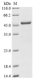 (Tris-Glycine gel) Discontinuous SDS-PAGE (reduced) with 5% enrichment gel and 15% separation gel.