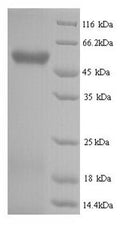 Recombinant Human Hyaluronidase-2 (HYAL2) – Figure 1 of 1