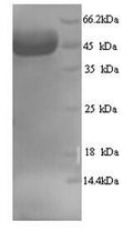 Recombinant Human Myosin-binding protein C, fast-type (MYBPC2), partial – Figure 1 of 1