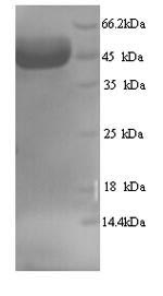 Recombinant Human Myosin-binding protein C, fast-type (MYBPC2), partial – Figure 1 of 1