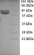 Recombinant Human ELAV-like protein 3 (ELAVL3) – Figure 1 of 1